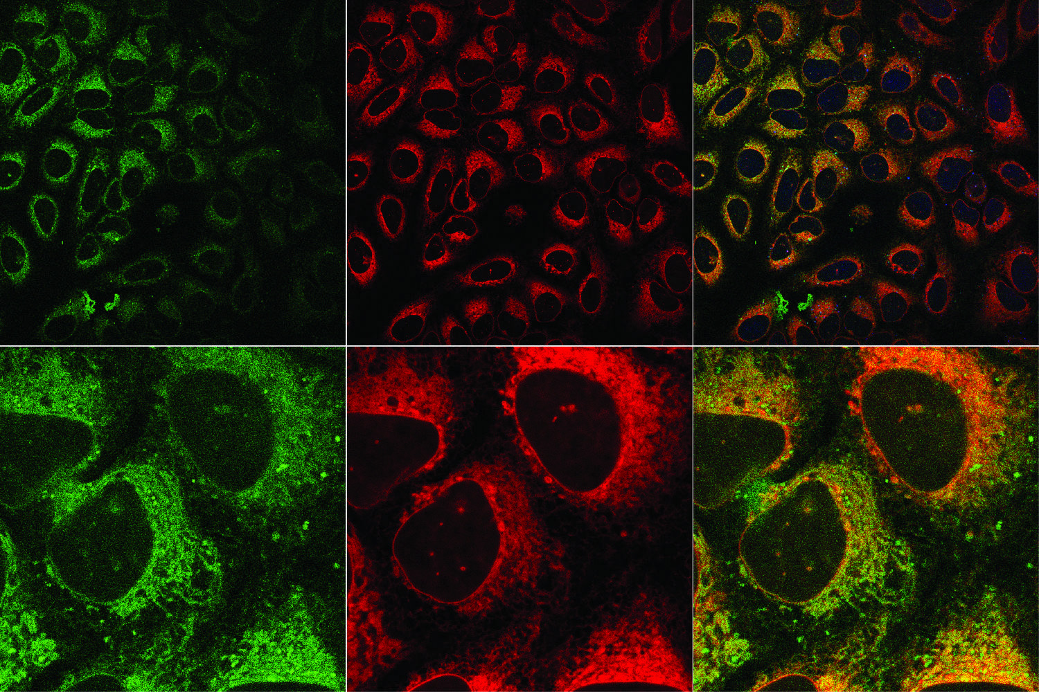 Organic reactions in live cells – a new fluorogenic click reaction for selective cell-labeling