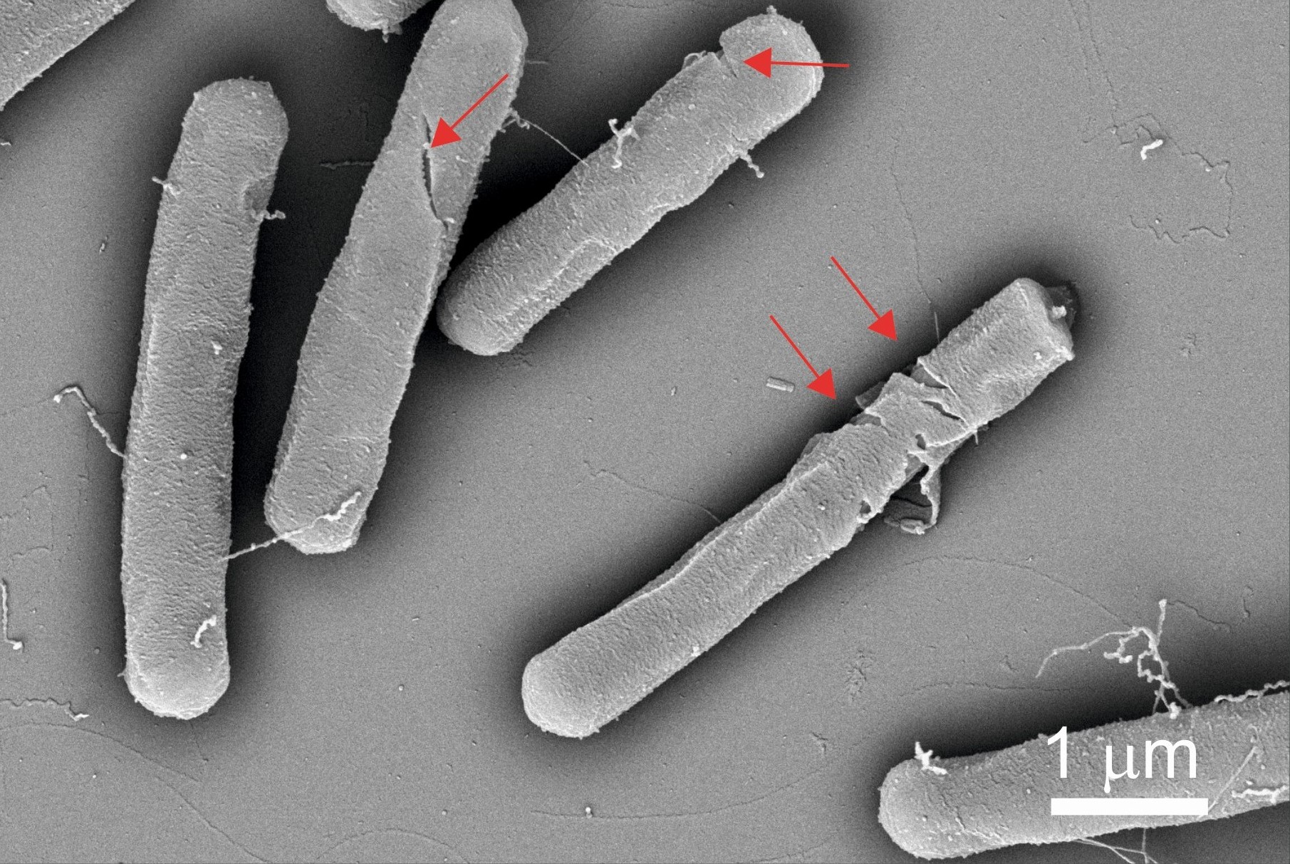 NANO-LPPO – Nový nanomateriál pro léčbu kožních infekcí